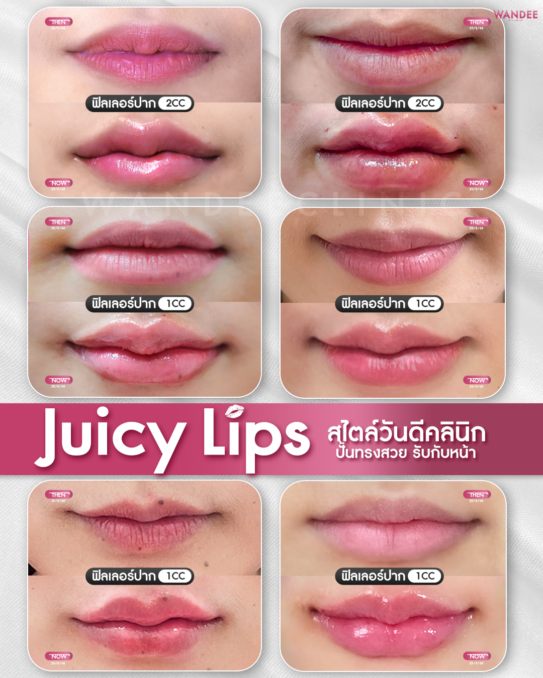 juicy lips