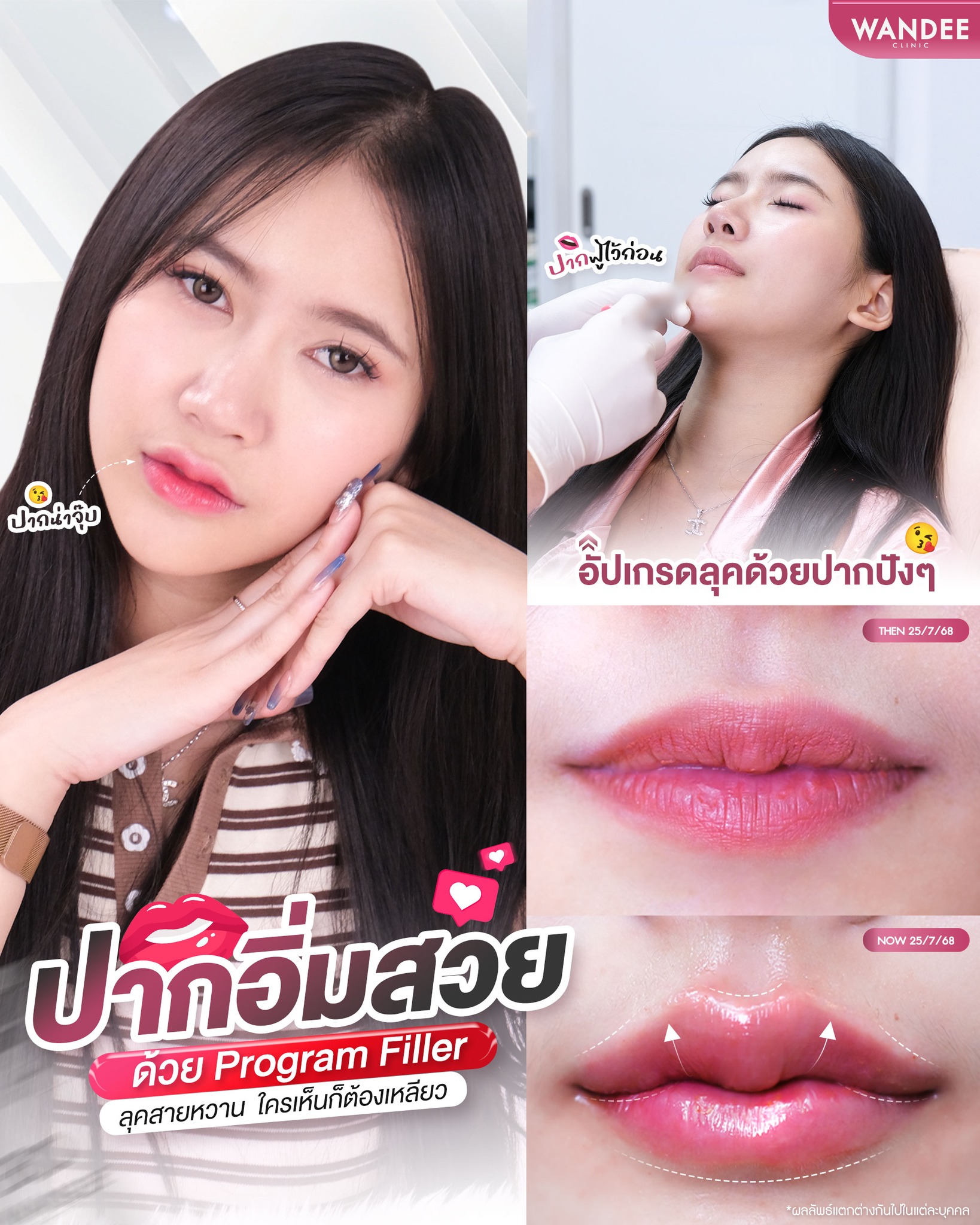 ปากอิ่มสวย