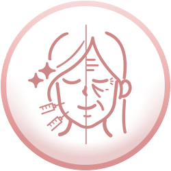 โบท็อกซ์